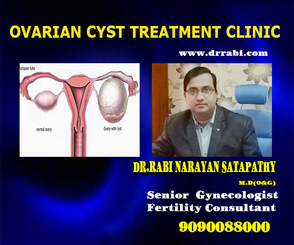 best ovarian cyst treatment clinic in bhubaneswar near me - dr rabi
